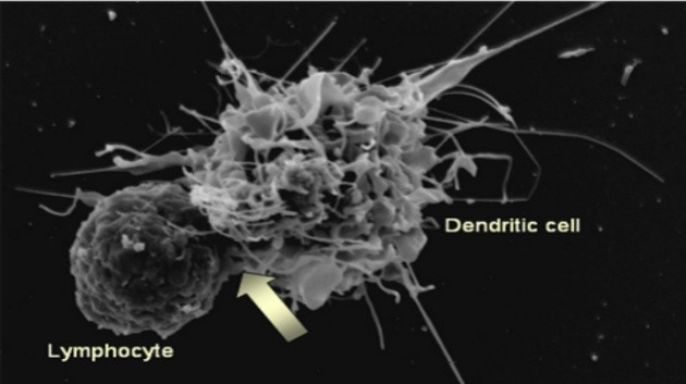 дендритные клетки